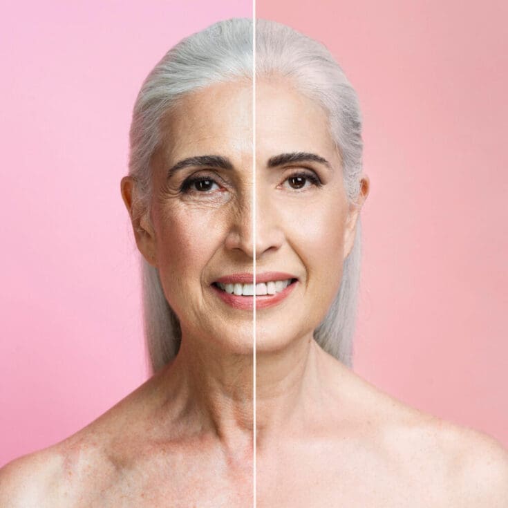 Anti Aging